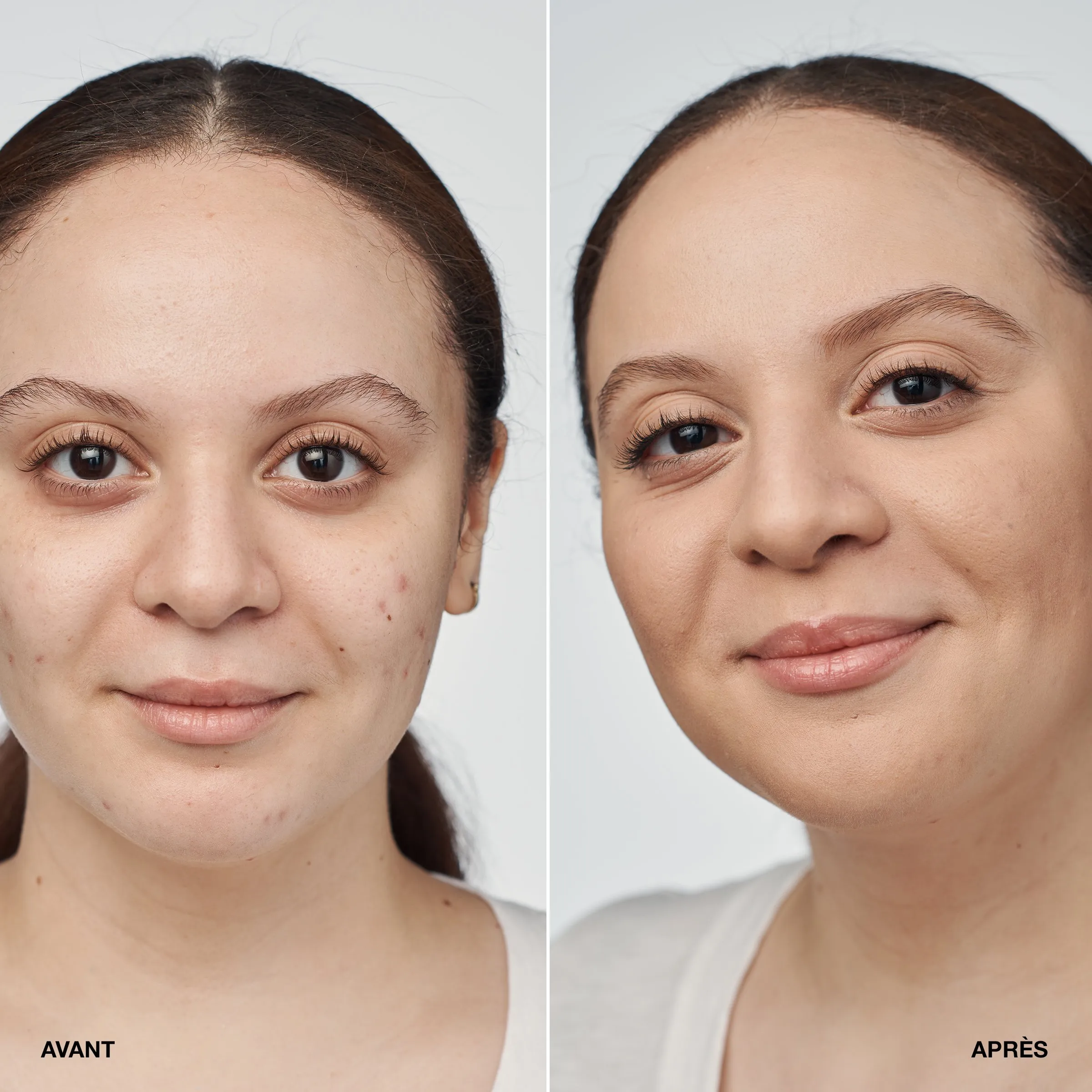  CLINIQUE   Even Better Clinical Serum Foundation SPF 20 - Siero fondotinta |  - CN 28 Ivory
